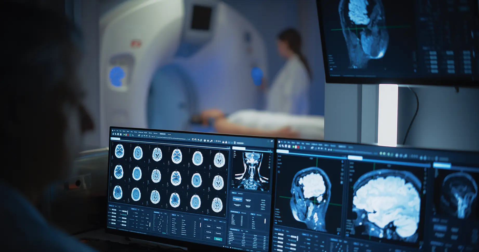 MRI scan being reviewed after a car accident injury claim in Arizona